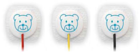 Ambu Pediatric Electrode, box/300 pcs (100 sets of 3 pcs)
